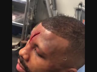 worst injury in boxing